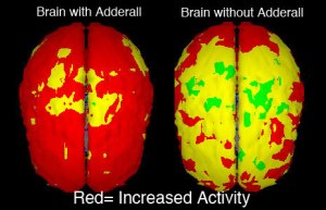 Brain Chemical Responses with Adderall Versus Without Adderall