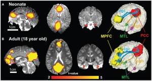 The color of connected brain clusters encodes t values. 3D visualization on the most right panels reveals clearly that cingulate gyrus part of cingulum (cgc) connects MPFC and PCC and cingulum hippocampal part (cgh) connects PCC and MTL for both neonate and adult brain